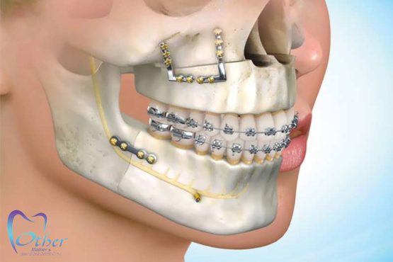 همه چیز دربارۀ جراحی فک و صورت 